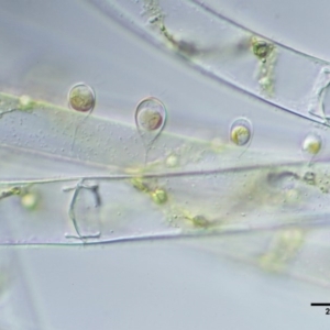 Spirogyra sp. at Mount Clear, ACT - 7 Jan 2017 11:17 AM