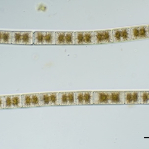 Zygnema sp. at Mount Clear, ACT - 7 Jan 2017