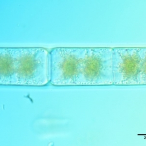 Zygnema sp. at Mount Clear, ACT - 7 Jan 2017 11:17 AM