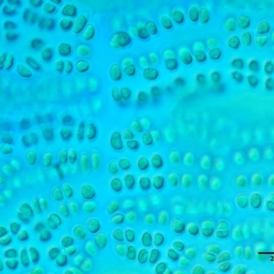 Parallela novae-zelandiae at Cotter River, ACT - 27 Jan 2017 10:19 AM