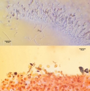 Tremella foliacea group at Coree, ACT - 28 Apr 2017