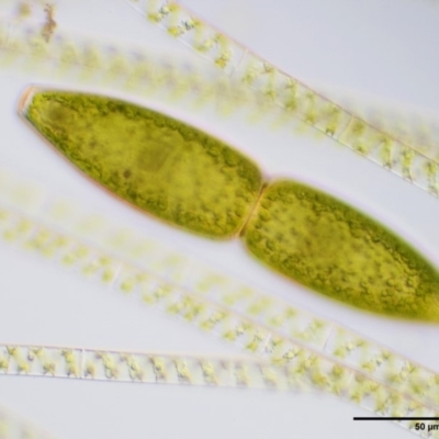Pleurotaenium truncatum (A desmid freshwater algae) at Coree, ACT - 20 Nov 2018 by KenT