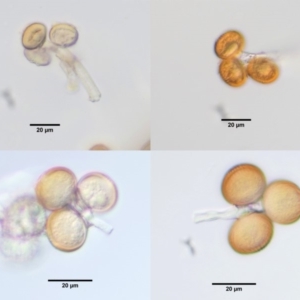 Uromycladium tepperianum s.lat. at Booth, ACT - 14 Jan 2019