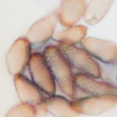 Uromycladium robinsonii at suppressed - 21 Apr 2022 12:14 PM