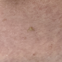 Unidentified at suppressed - 18 Jan 2023