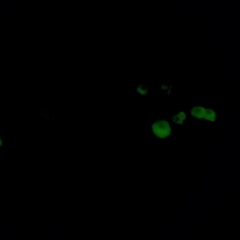 Unverified at suppressed - suppressed