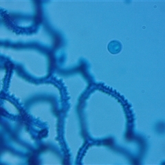 Arcyria denudata at suppressed - suppressed