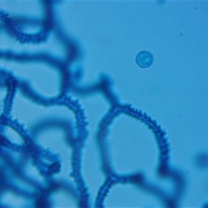 Arcyria denudata at suppressed - suppressed