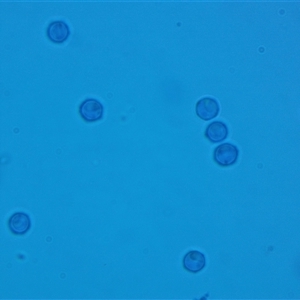 Arcyria denudata at suppressed - suppressed