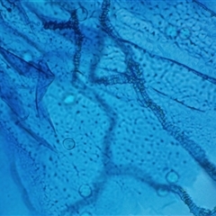 Heterotrichia spp. at Hawker, ACT - 6 Apr 2025 04:38 PM