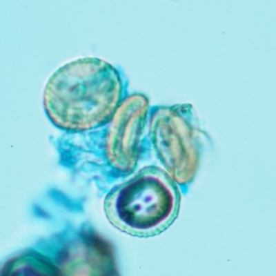 Uromycladium tepperianum s.lat.