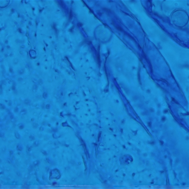 Heterotrichia spp.