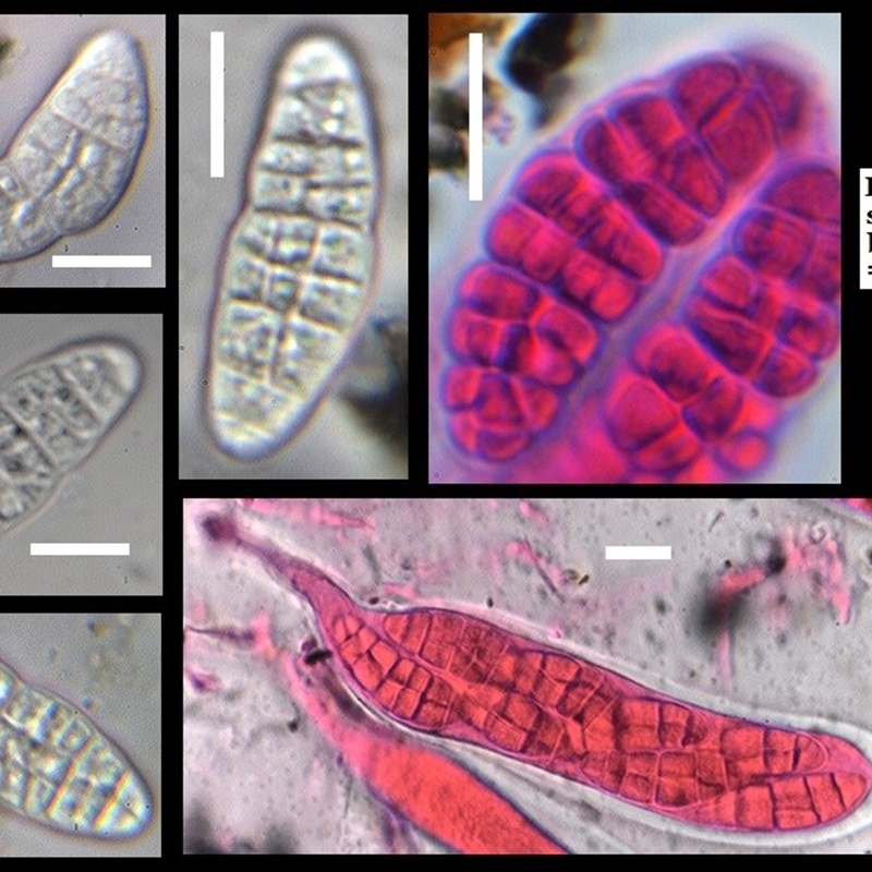 Gloniopsis praelonga